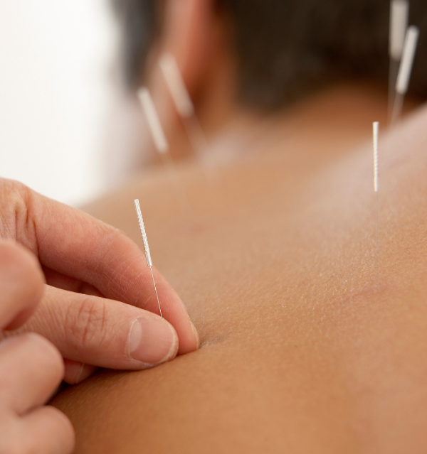 Trattamento di fisioterapia presso Istituto Hospardo Messina